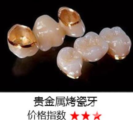半贵金属烤瓷牙(半贵金属烤瓷牙和国产氧化锆全瓷冠)
