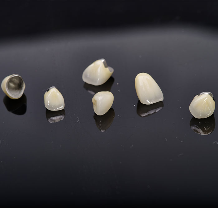 贵金属牙桩(贵金属牙桩影响核磁共振吗)