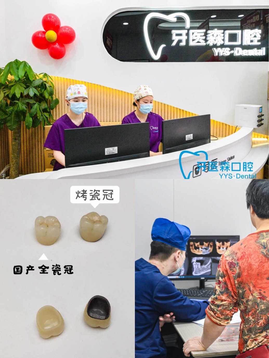 贵金属烤瓷冠(贵金属烤瓷冠是什么材质)