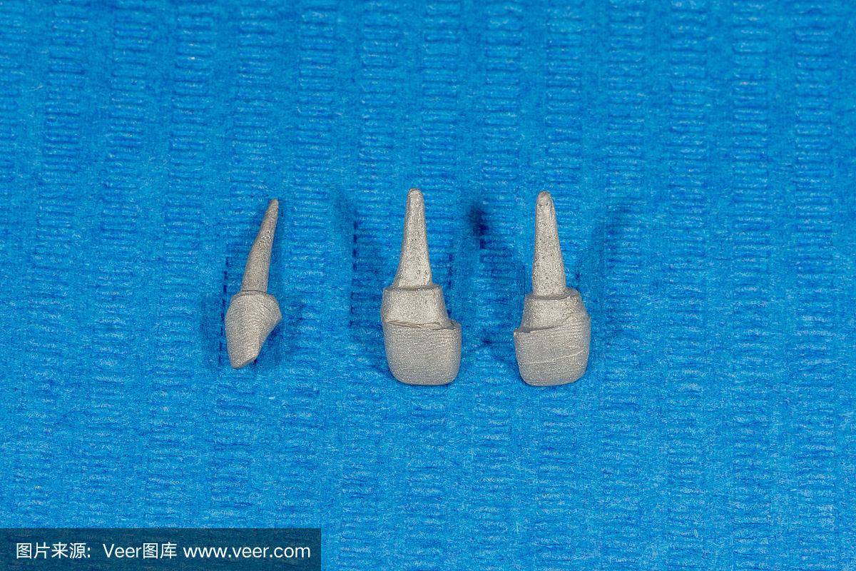 贵金属牙桩(贵金属牙桩会不会断裂) 贵金属牙桩(贵金属牙桩会不会断裂)